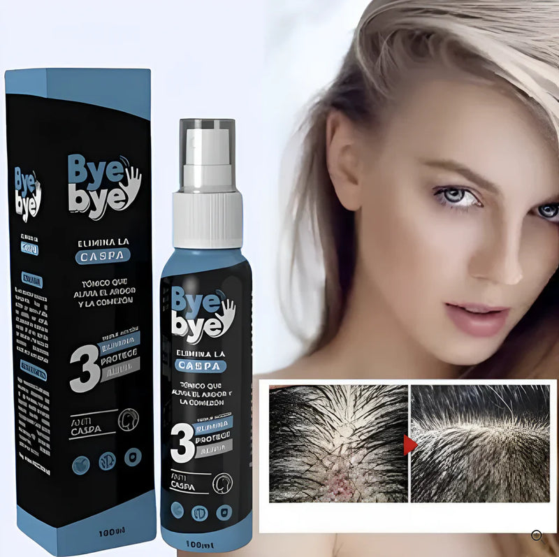 ByeBye™ - Spray Anticaspa